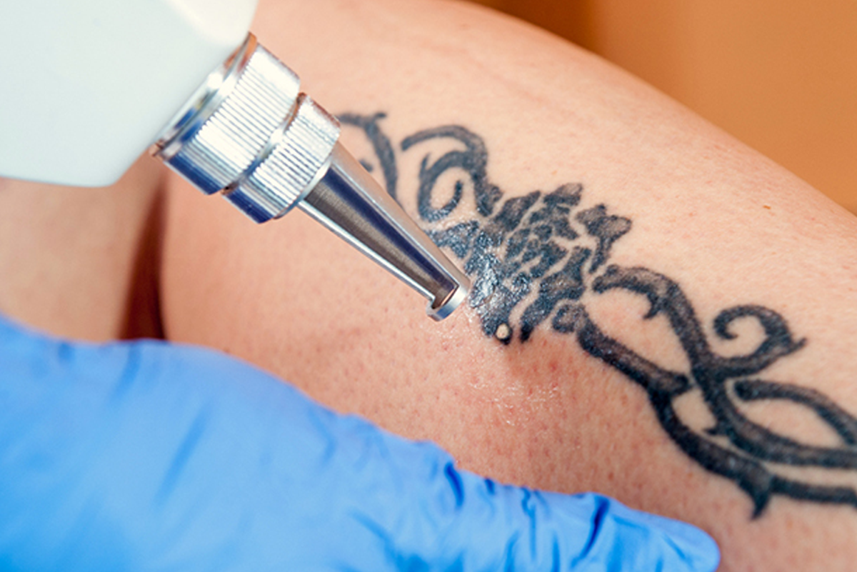 îndepărtați un tatuaj elvețian anti-îmbătrânire